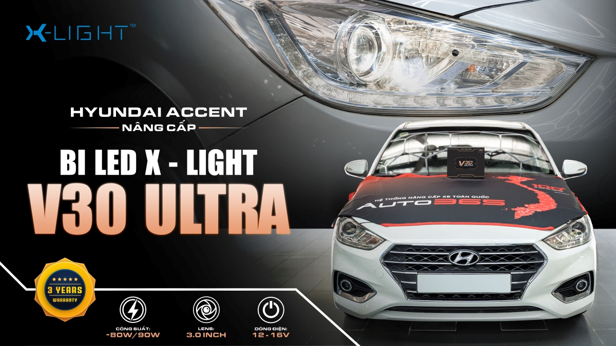 Hyundai Accent nâng cấp Bi LED X-Light V30 Ultra tại Auto365